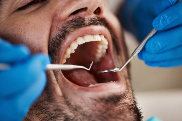 Best Emergency Tooth Extraction  in Anthony, KS