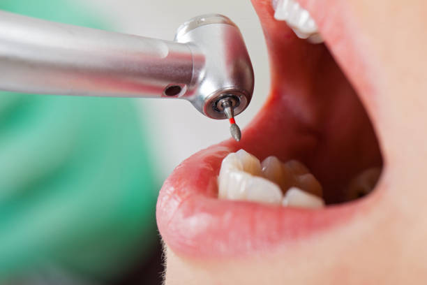 Best Affordable Emergency Dental Care  in Anthony, KS